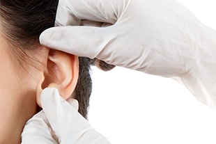 Otoplastie ou chirurgie des oreilles décollées à Mulhouse